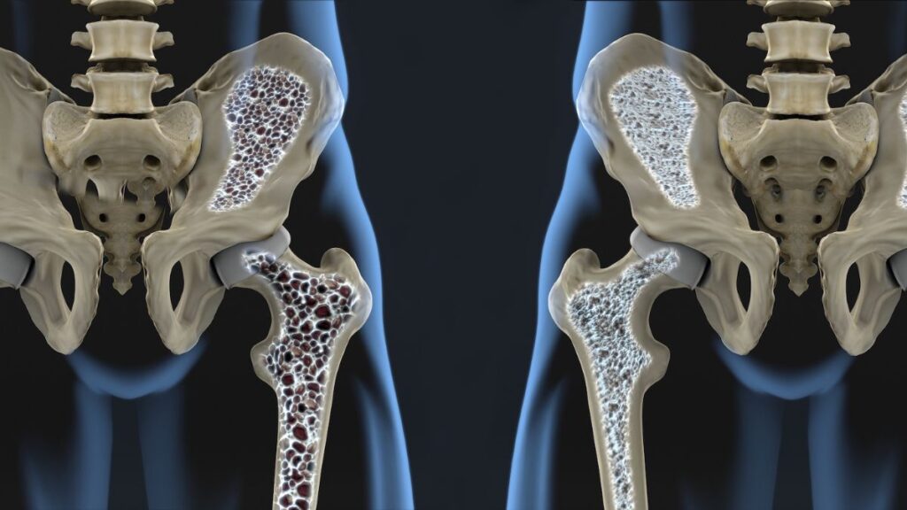 Osteopur