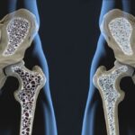The Science Behind Osteopur: Why It Stands Out in Bone Care